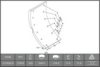 BERAL 1763512006015603 Brake Lining Kit, drum brake